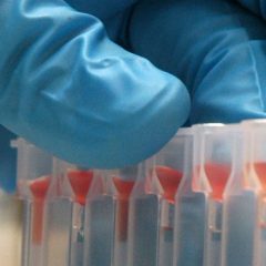 Toshibina izjemna nova naprava zazna do 13 vrst raka iz ene kaplje krvi